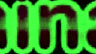 Outdoor teen lesbian strips off and climbs around