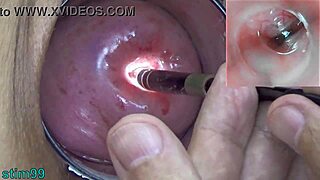 Mature Japanese MILF undergoes extreme cervix insertion with endoscope.