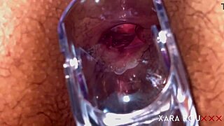 Anal speculum reveals gaping BBW ass wide open 😏